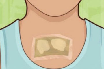 Comment éliminer le mucus qui s’accumule dans vos poumons dans la nuit grâce aux peaux de gingembre